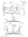 Fig. 06 - Prosthetic heart valve