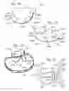 Fig. 11 - Prosthetic heart valve
