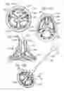 Fig. 15 - Prosthetic heart valve