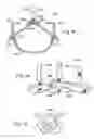 Fig. 18 - Prosthetic heart valve
