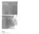 Fig. 06 - IMPLANT FOR PROSTHESES