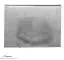 Fig. 07 - IMPLANT FOR PROSTHESES