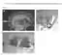 Fig. 02 - Screening methods for compounds useful for treating pancreatic dysfunction