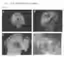 Fig. 13 - Screening methods for compounds useful for treating pancreatic dysfunction