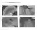Fig. 24 - Screening methods for compounds useful for treating pancreatic dysfunction