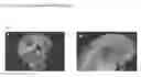 Fig. 29 - Screening methods for compounds useful for treating pancreatic dysfunction