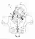 Fig. 07 - HEAD PROTECTION SYSTEM