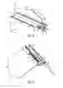 Fig. 06 - Guide system for nacelle assembly