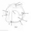 Fig. 06 - Pendant button cover with magnetic latch