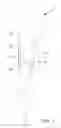 Fig. 04 - Torque wrench