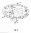 Fig. 03 - Orbital device with stowable mount