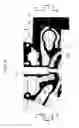 Fig. 07 - CYLINDER HEAD FOR AN INTERNAL COMBUSTION ENGINE, WITH INTEGRATED EXHAUST MANIFOLD