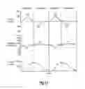 Fig. 22 - System for providing flow-targeted ventilation synchronized to a patient's breathing cycle