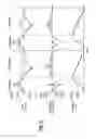 Fig. 32 - System for providing flow-targeted ventilation synchronized to a patient's breathing cycle