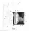 Fig. 02 - MASK AND METHOD FOR DELIVERING A THERAPEUTIC BREATHABLE SUBSTANCE