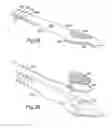 Fig. 09 -  AIRWAY DEVICE