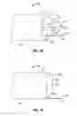 Fig. 02 - System and Method for Diverticulitis Treatment