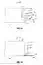 Fig. 02 - System and Method for Diverticulitis Treatment