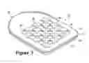 Fig. 04 - Method of manufacturing a contoured fluid-filled chamber with a tensile member