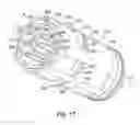 Fig. 16 - Running adapter