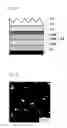 Fig. 05 - Microlens for organic EL element, organic EL element using the same, and manufacturing methods thereof