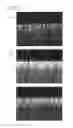 Fig. 06 - MOLD, MOLD MANUFACTURING METHOD AND METHOD FOR MANUFACTURING ANTI-REFLECTION FILM USING THE MOLD