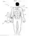 Fig. 40 - System including wearable power receiver and wearable power-output device