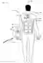 Fig. 01 - Wearable power-output device operable to deliver wirelessly received power