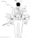 Fig. 09 - Wearable power-output device operable to deliver wirelessly received power