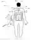 Fig. 10 - Wearable power-output device operable to deliver wirelessly received power