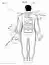 Fig. 17 - Wearable power-output device operable to deliver wirelessly received power