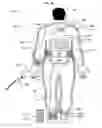 Fig. 31 - Wearable power-output device operable to deliver wirelessly received power