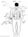 Fig. 40 - Wearable power-output device operable to deliver wirelessly received power