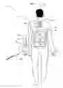 Fig. 02 - Wearable power source