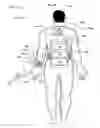 Fig. 40 - Wearable power source