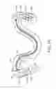 Fig. 02 - Dental bone conduction hearing appliance