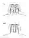 Fig. 02 - DEVICE FOR CONNECTING A BEVERAGE CONTAINER TO A FITTING