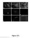 Fig. 16 - Methods and kits for detecting misfolded proteins