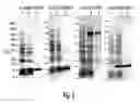 Fig. 03 - Compounds and methods for diagnosis and treatment of leishmaniasis