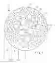 Fig. 02 - Embolization