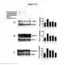 Fig. 07 - Composition from Sphaeranthus indicus and Garcinia mangostana for the control of metabolic syndrome