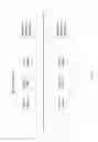 Fig. 11 - Vertically Aligned Carbon Nanotube Augmented lithium Ion Anode for Batteries