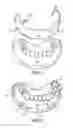 Fig. 02 - Cosmetic Prosthesis and Methods for Making the Same