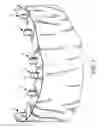 Fig. 02 - Components for permanent removable and adjustable dentures and bridges
