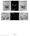 Fig. 12 - Rationale, methods, and assays for identifying human and non-human primate taste specific genes and use thereof in taste modulator and therapeutic screening assays