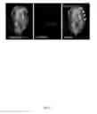 Fig. 22 - Rationale, methods, and assays for identifying human and non-human primate taste specific genes and use thereof in taste modulator and therapeutic screening assays