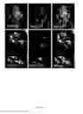 Fig. 46 - Rationale, methods, and assays for identifying human and non-human primate taste specific genes and use thereof in taste modulator and therapeutic screening assays