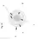Fig. 04 - Catheter pump for circulatory support