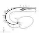 Fig. 22 - Catheter pump for circulatory support
