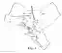 Fig. 04 - TRANSOBTURATOR SURGICAL ARTICLES AND METHODS